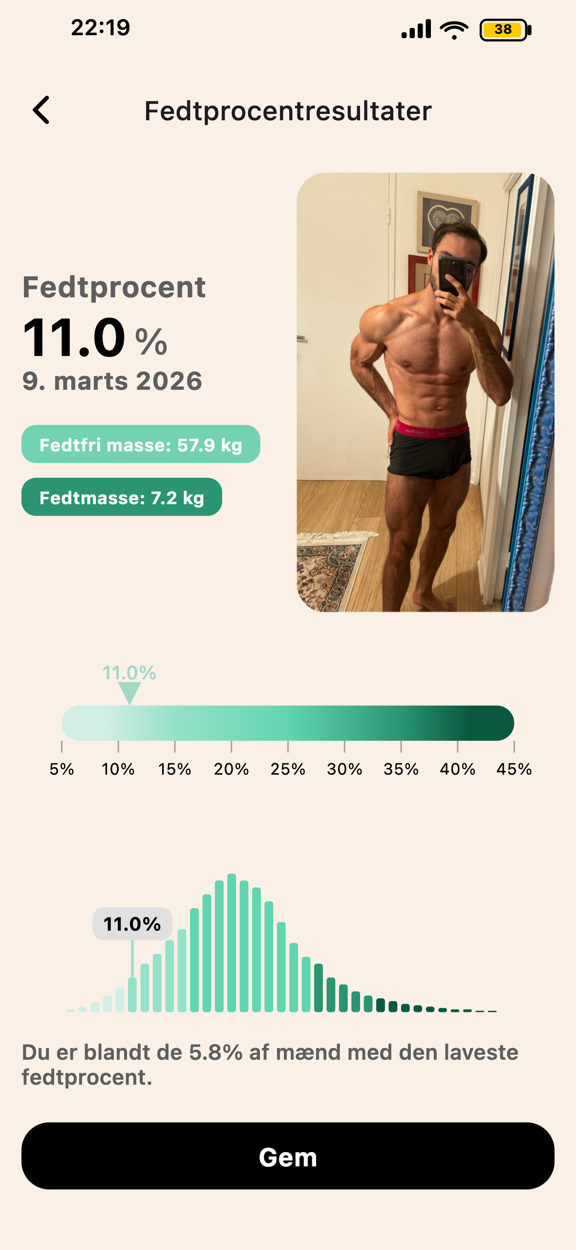 R&eacute;sultat BodyScan IA dans Lean
